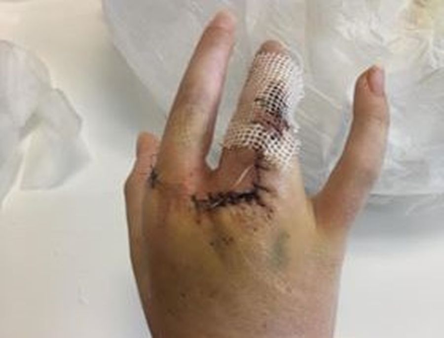 Hand