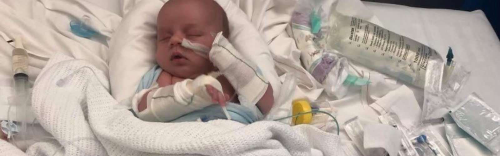 Baby Jack is in a hospital bed with medical equipment