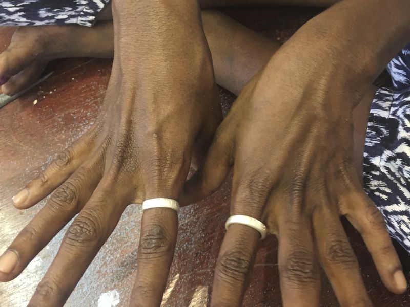 Sasha Mununggurr shows both of her hands with silver rings placed on both index fingers