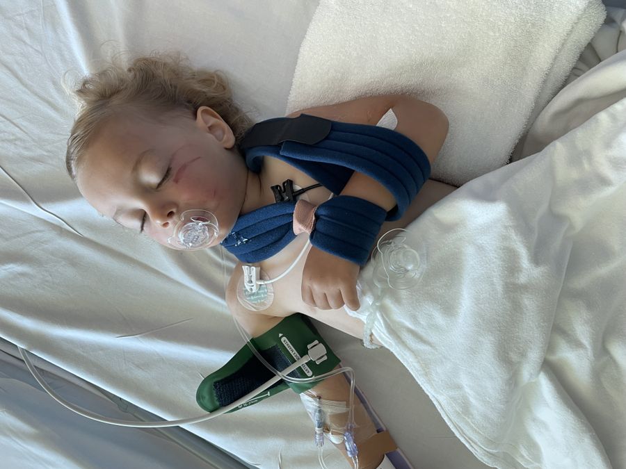 Parker's crush injuries were too severe to be treated at Esperance hospital, so the RFDS was called in to take the toddler to Perth,
