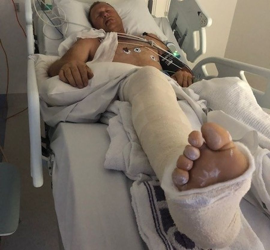 Phil's injuries to his upper body were only discovered after a few days in hospital.