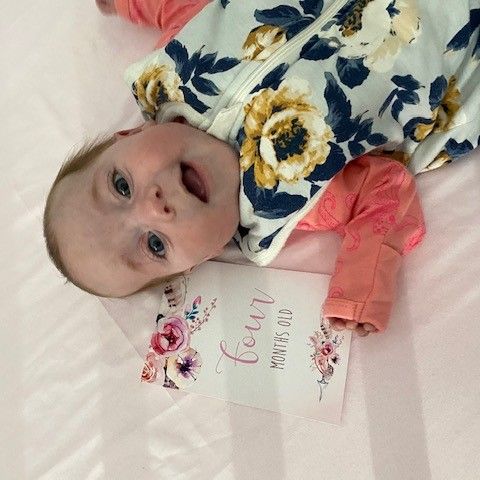 Four month old Grace