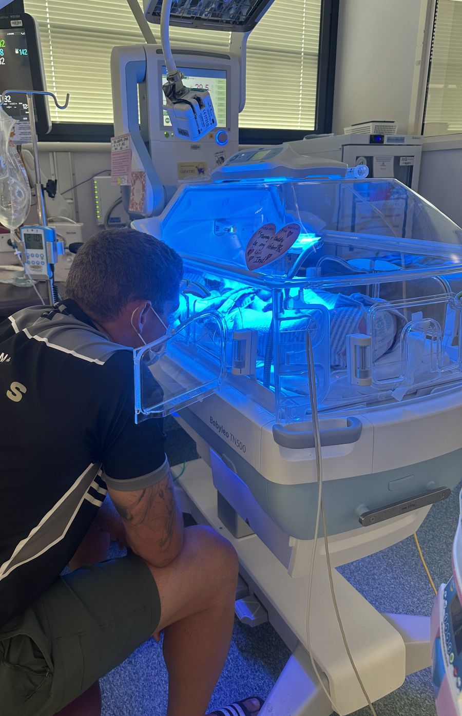 One year on, baby Indi is thriving