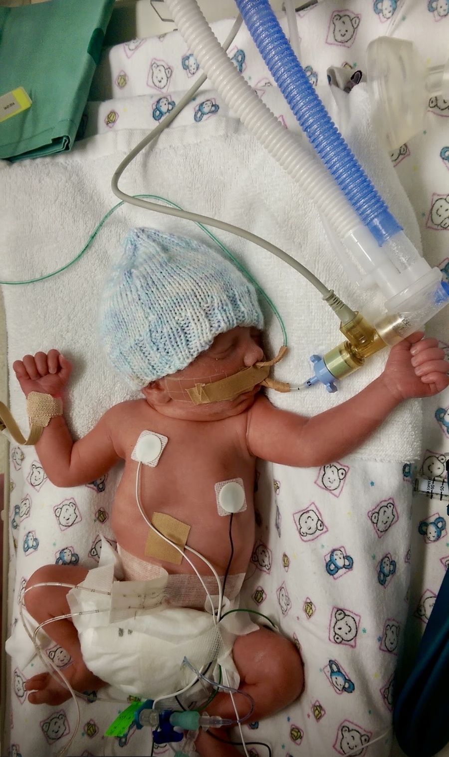 Baby Taylor in the Hospital