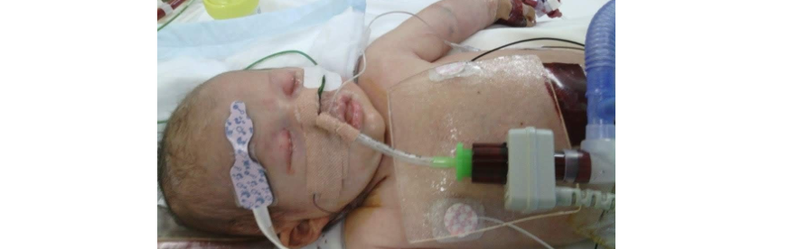 Kate Napier - Podcast Story 