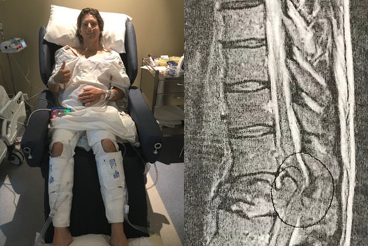 Alex Lawrie post surgery