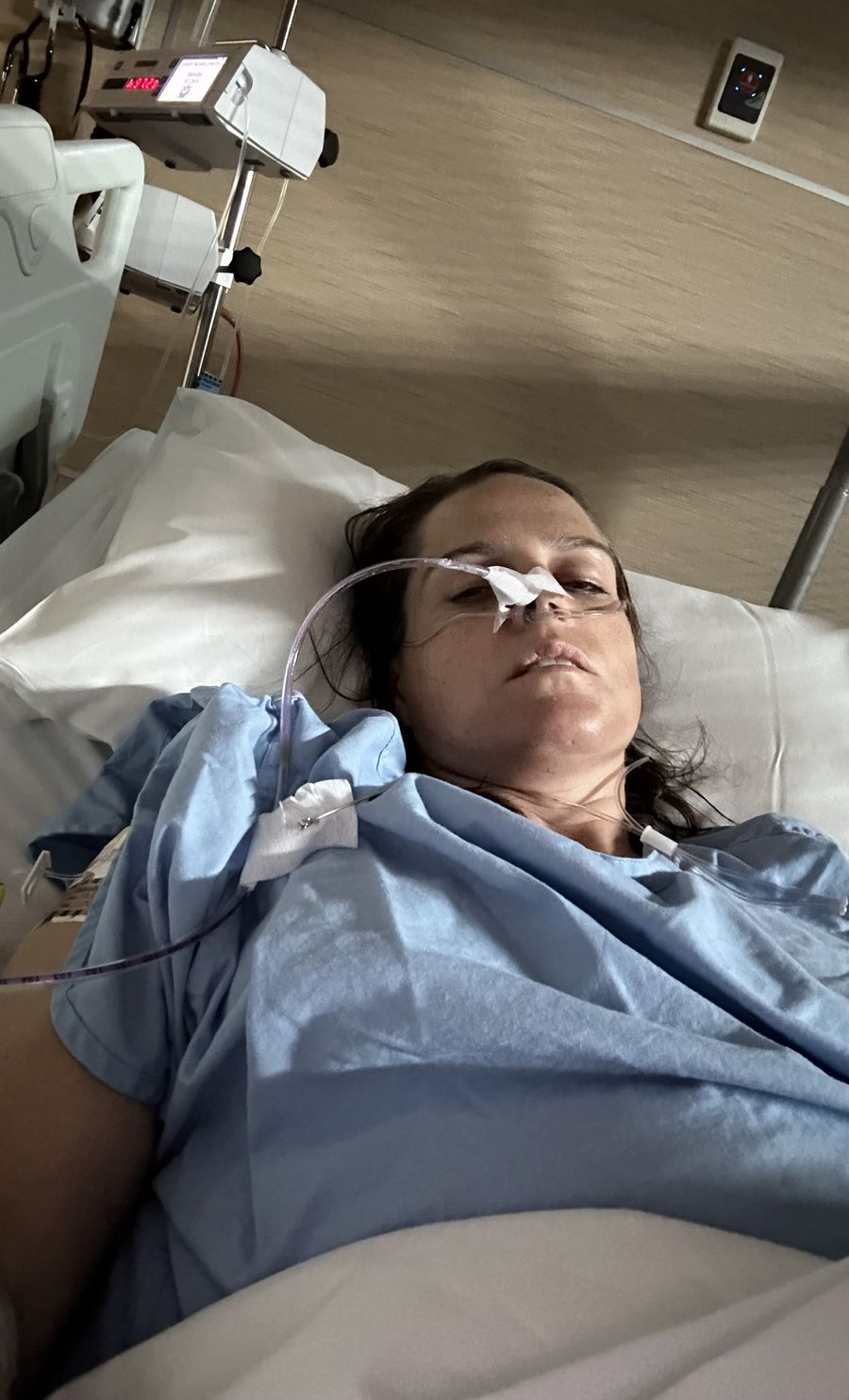 After suffering a Crohn's flare and then a bowel obstruction, Veronica required surgery.