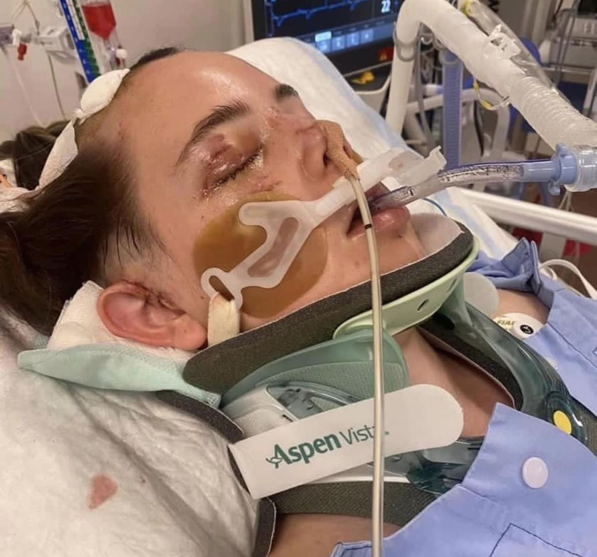 Bella laying unconscious on a hospital bed.