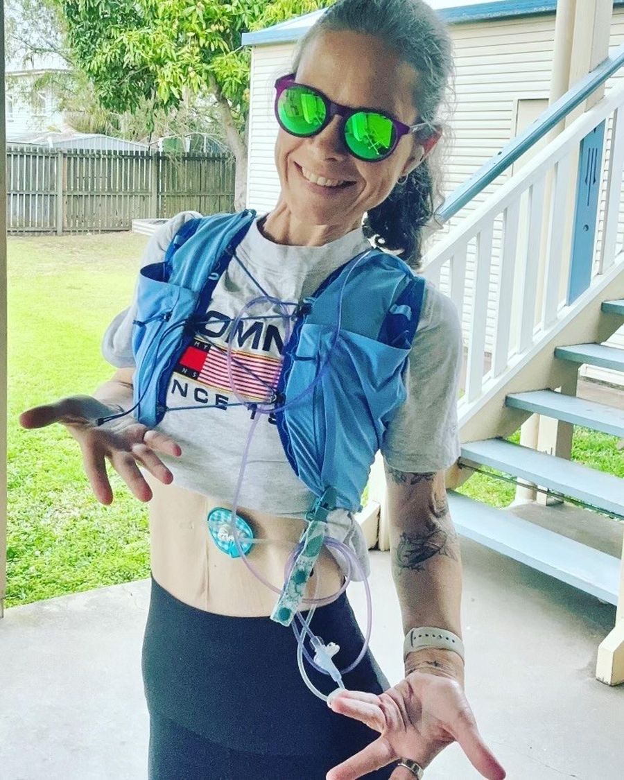 Juliet with the tube