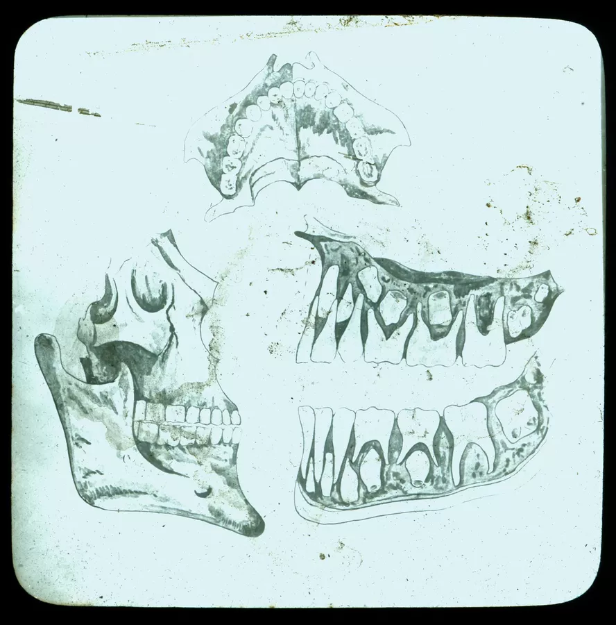 Anatomical drawing: the jaw - AGSA Collection