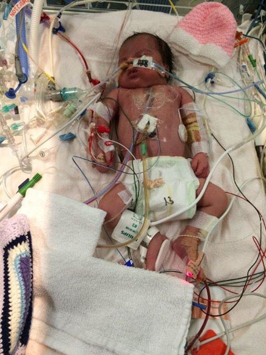 Calvary in open heart surgery