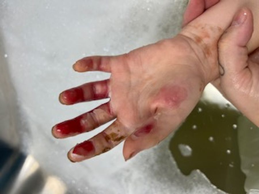 Mia's hand 