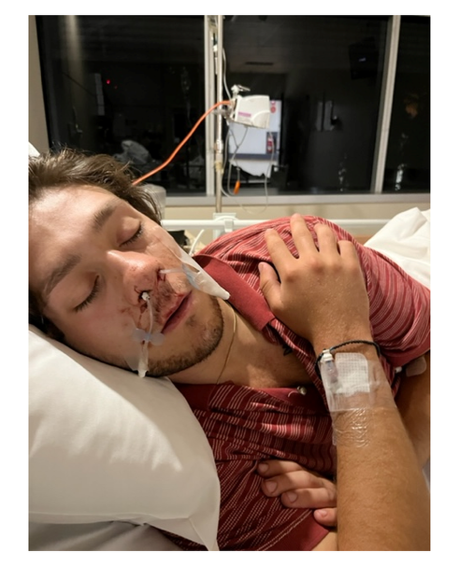 Nicholas bleeding from his nose 