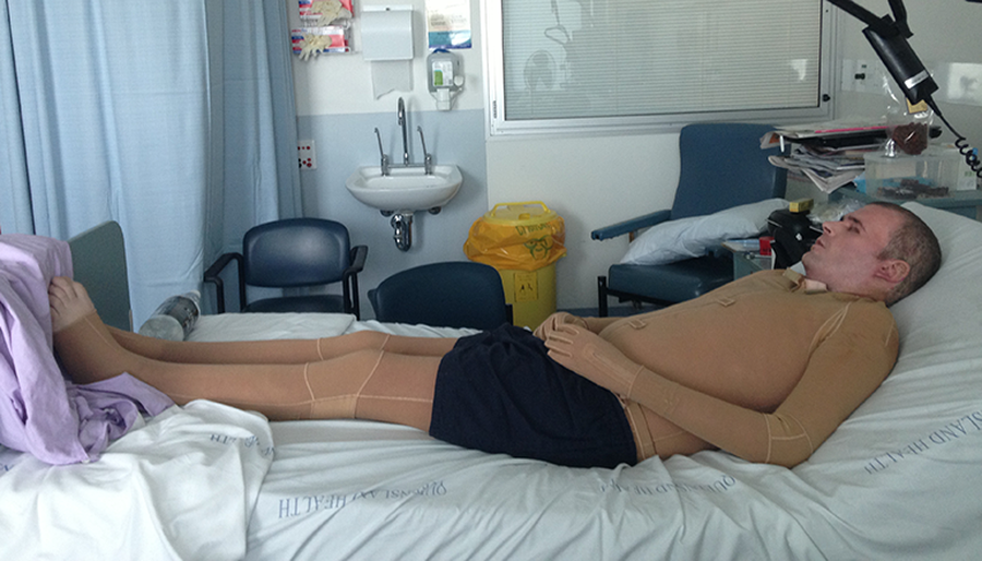 Face mask in the burns unit