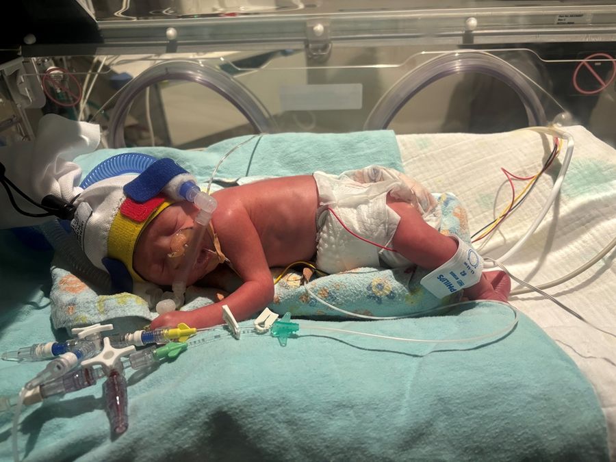 Baby Henry in NICU