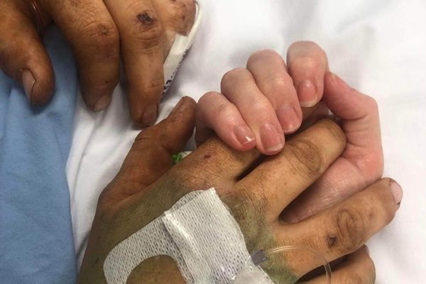 #58 How did Mack keep himself alive, under a rolled-car, in remote Western Australia?