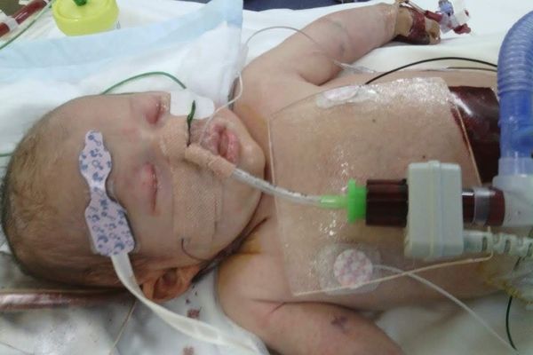 Kate Napier - Podcast Story 