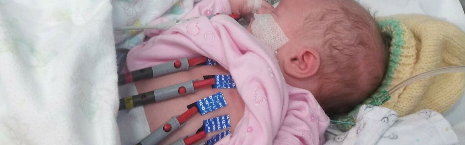 Annabelle undergoes tests at Rockhampton Base Hospital at only 11 days old. 