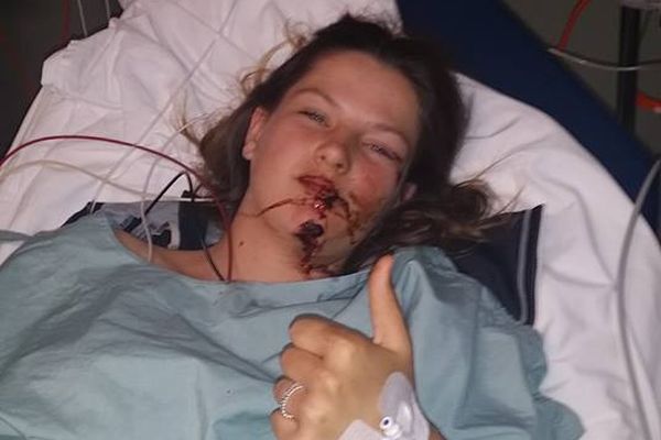 Natasha after the accident